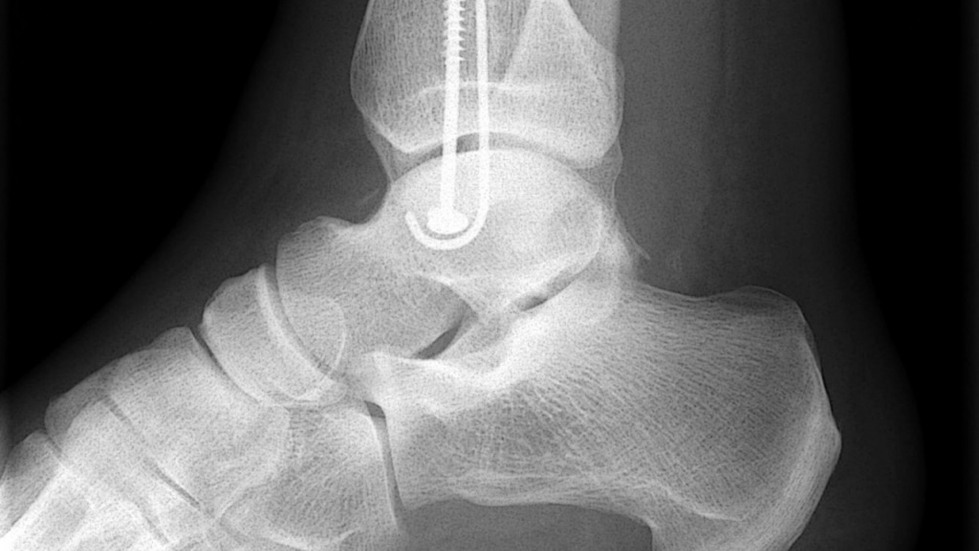 Röntgenstrahlen wissen.de