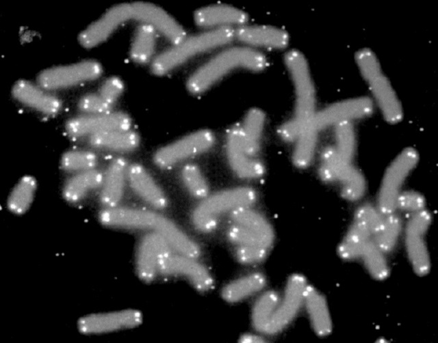 Menschliche Chromosomen (grau) mit weiß markierten Telomeren an den Enden.