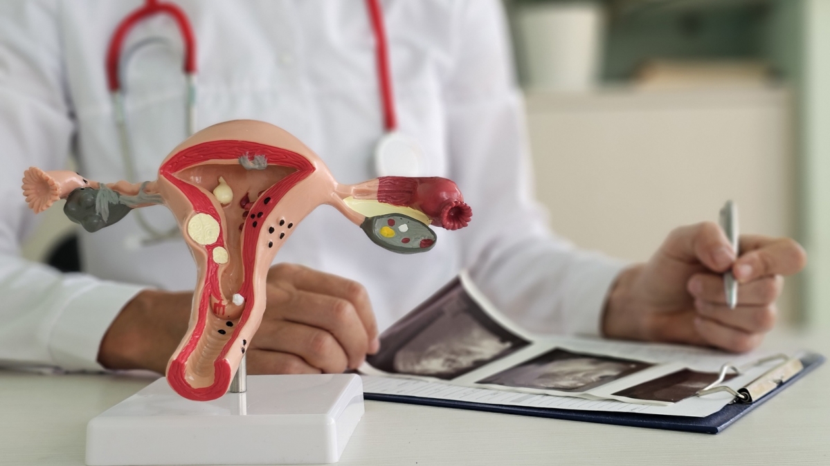 Arzt erklärt der Patientin Veränderungen der Eierstöcke am künstlichen Modell der Gebärmutter und zeigt Ultraschallbild 