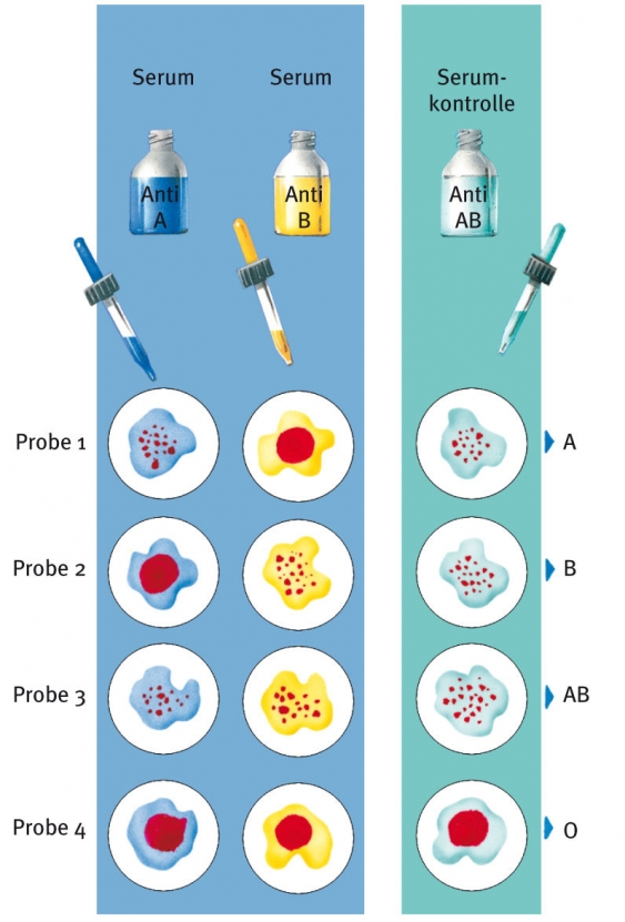 Blut, aus dem Gesundheitslexikon Gesundheit, Medizin und Heilkunde
