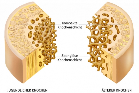 Kompakta, aus dem Gesundheitslexikon Gesundheit, Medizin und