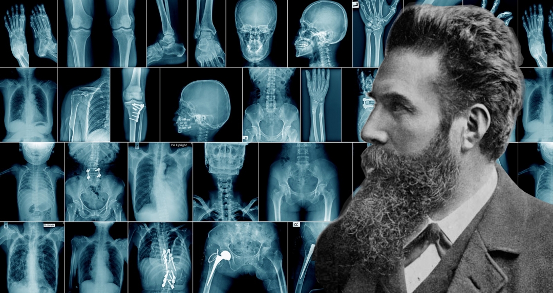 Conrad Wilhelm Röntgen und die 