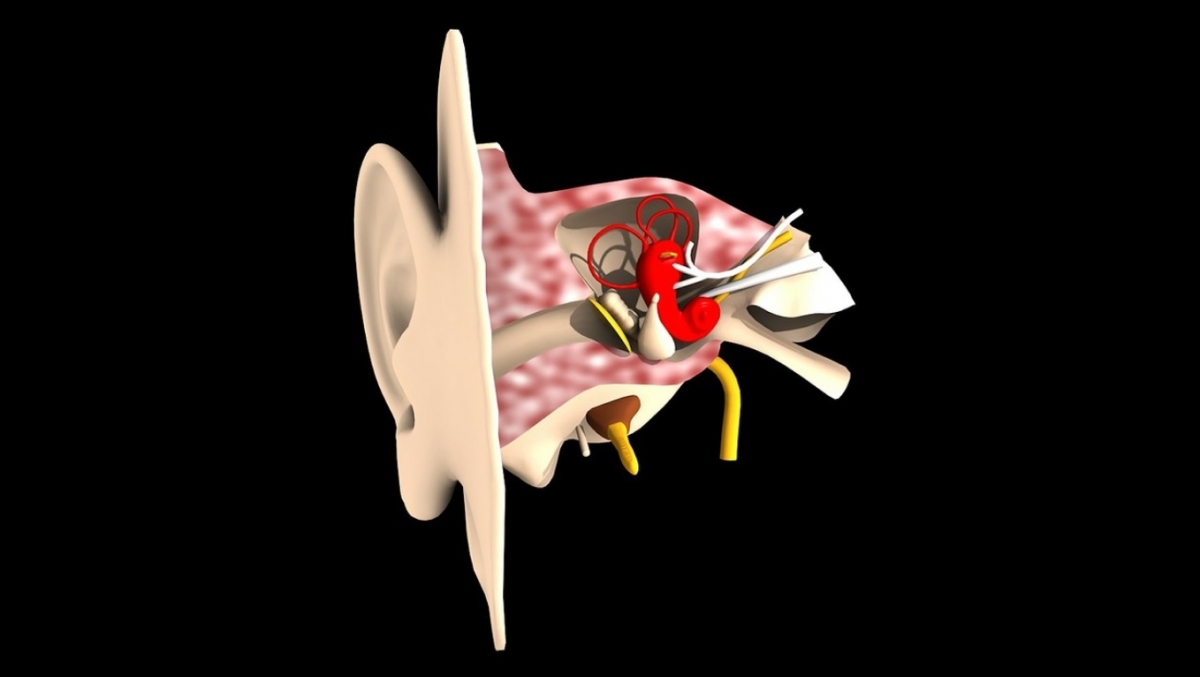 Wann Bekommt Man Ein Cochlea Implantat Wissende