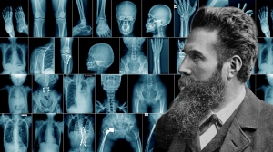 Wilhelm Conrad Röntgen vor vier Reihen von Röntgenbildern