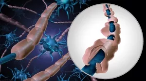 Schäden an der Myelinscheide iner Nervenbahn als Verursacher von MS