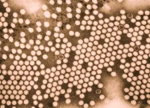 Polioviren im Elektronenmikroskop