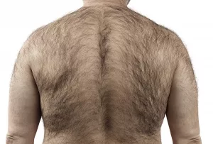 Rückenbehaarung