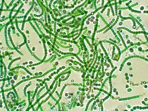 Cyanobakterien der Gattung Nostoc
