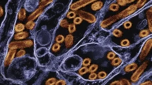 Elektronenmikroskop-Aufnahme von H5N1 (goldfarben)