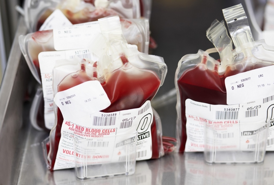 Bluttransfusion Bei Alten Menschen Nebenwirkungen