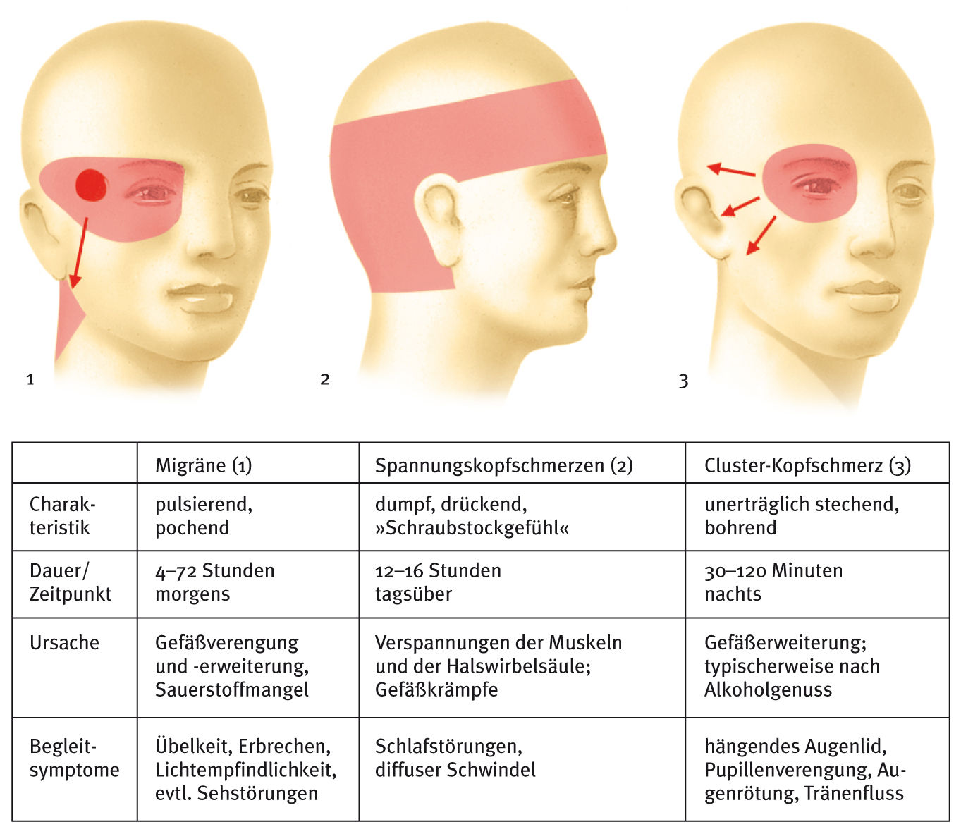 Тянет лоб. Зоны головной боли. Боль в затылке и лобной части. Болит голова в лобной части. Схема локализации головной боли.